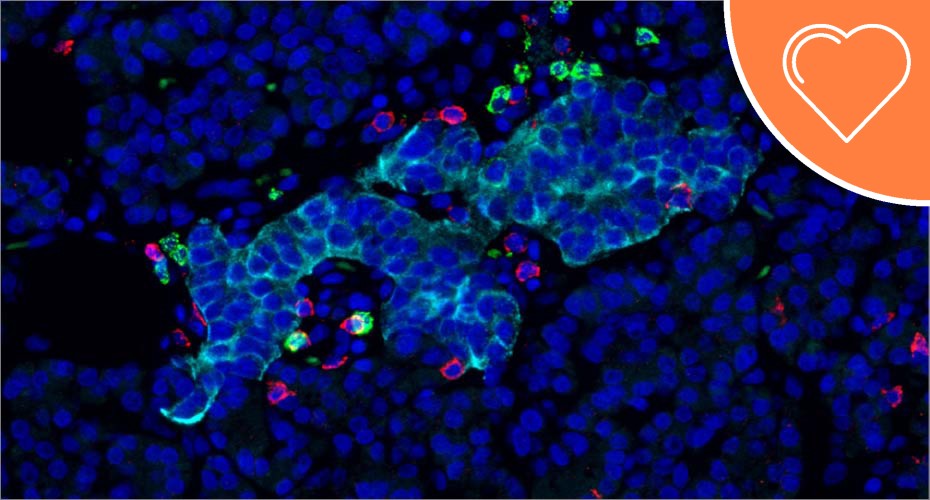 Diabetes - clinical and biomedical sciences research theme