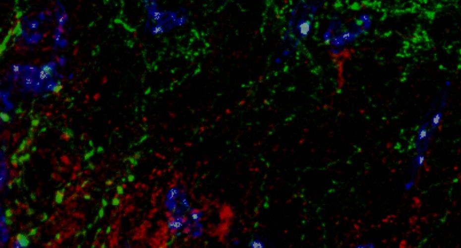 Exeter Neuroendocrine Research Group