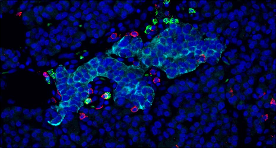 Cell Biology of Diabetes